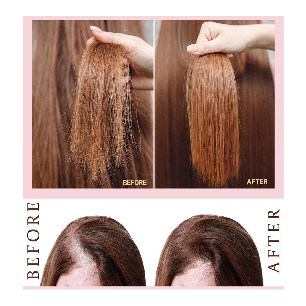 MD-1 Peptide Complex Scalp Ampoule Take care of your damaged hair easily